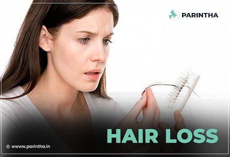 Iron Deficiency and Hair Loss